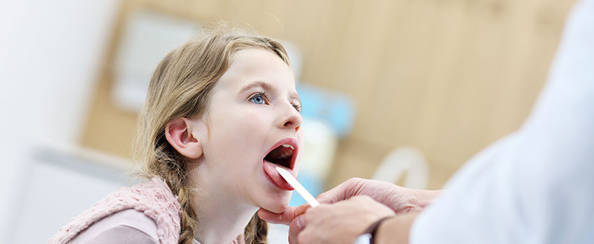 How Do I Know If I Have Strep Throat?