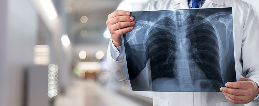 What’s the Purpose of an X-ray?