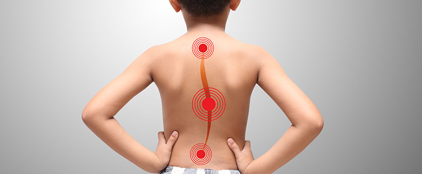 How Can I Tell If My Child Has Scoliosis?